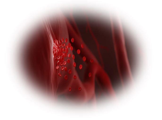 / image credit internal bleeding ©Artur/stock.adobe.com