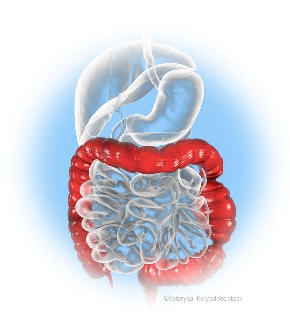 Irritable Bowel Syndrome Cohort Analysis Identifies 7 Distinct Latent Subsets  