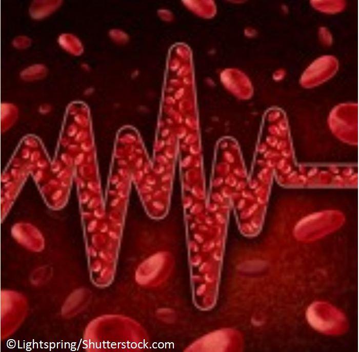 Anticoagulation for Atrial Fibrillation: Brief 3 Q and A