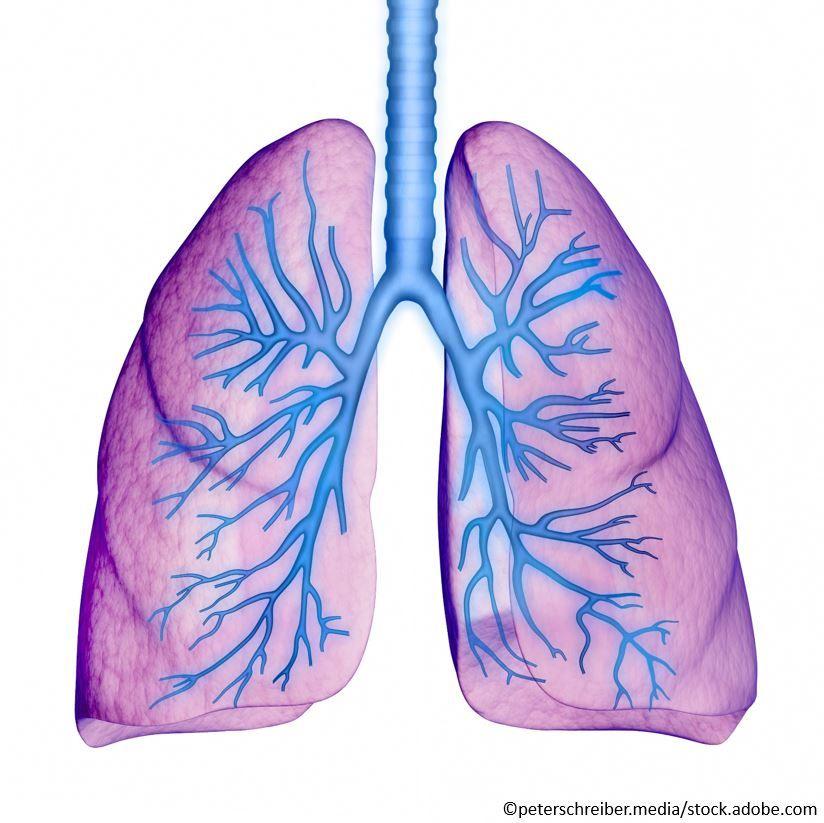 Chest X-ray Findings Normal in Patients with Confirmed COVID-19 