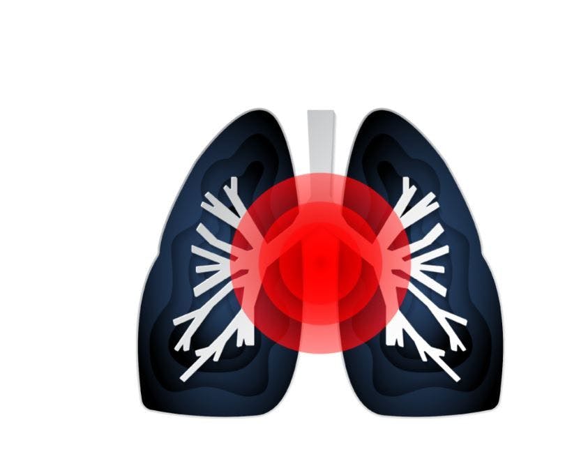 Exacerbations in asthma and COPD - guidelines quiz 