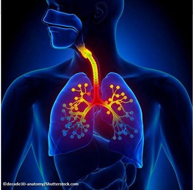 Novel Pathway May Trigger Non-inflammatory Asthma