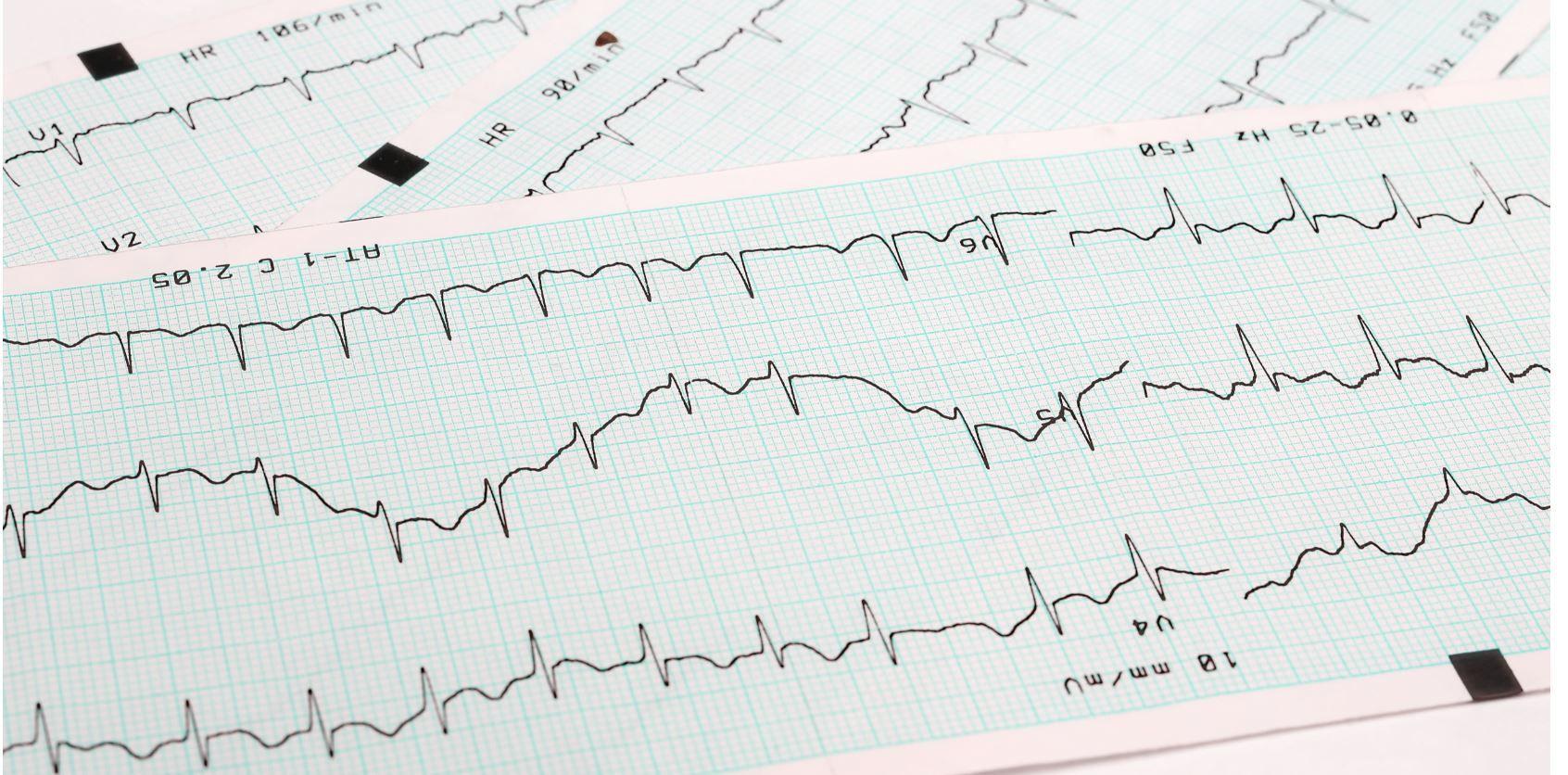 Experimental COVID-19 Treatments May Put CVD Patients at Risk 