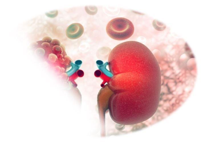 ADPKD, autosomal dominant polycystic kidney disease, kidney disease 