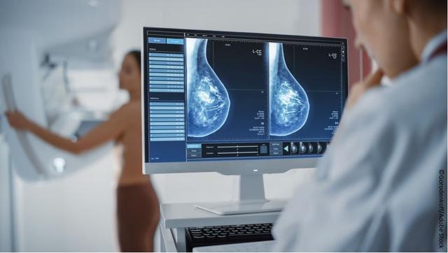 Mammography facilities are now nationally required to inform patients about their breast density, which can affect cancer detection. |© Gorodenkoff/stock.adobe.com