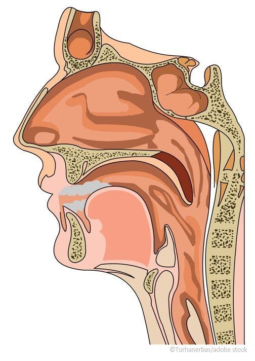 Dupilumab Wins Label Expansion with Indication for CRSwNP in Adolescents /image credit sinuses: ©turhanerbas/stock.adobe.com