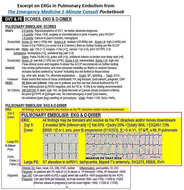 Pulmonary embolism 