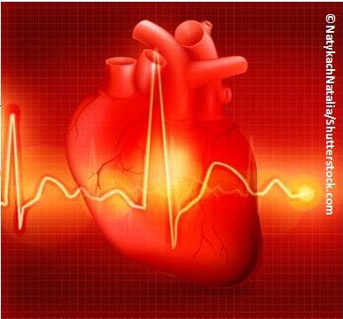 Atypical Afib May Augur Poor Prognosis 