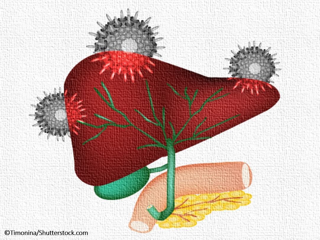 HCV, hep c, news, HCV news, primary care, 5 questions on HCV