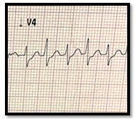 ECG Challenge: Weak and Faint 