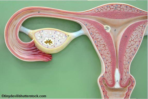 NSAIDs Affect Fertility of Women With Musculoskeletal Pain