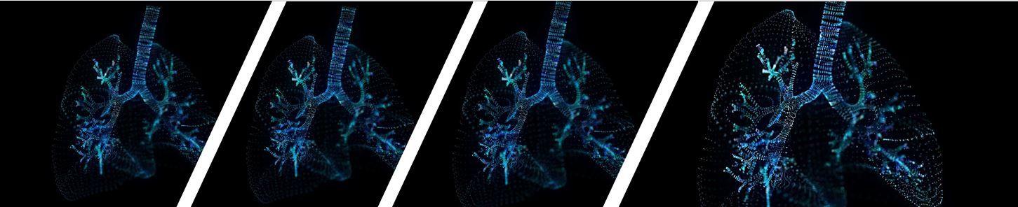 Dupilumab Reduces Nighttime Symptoms, Sleep Disturbance in Severe T2 Asthma / image credit lungs on black ©Sebastian Kaulitzki/stock.adobe.com