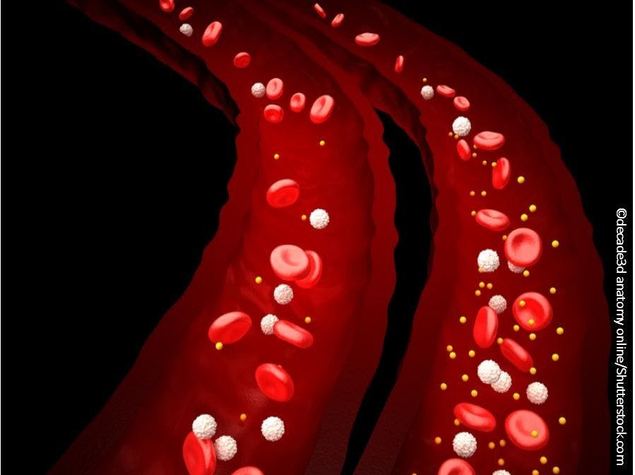 ACC Consensus Statement: Cessation of Anticoagulants for Elective Procedures