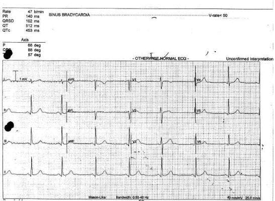 Loss of Consciousness: Your Dx?