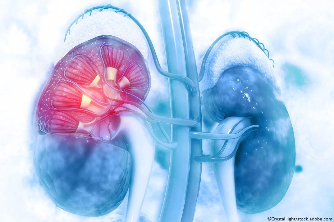 Kidney Week: Dapagliflozin Renoprotective, Cardioprotective in CKD Patients