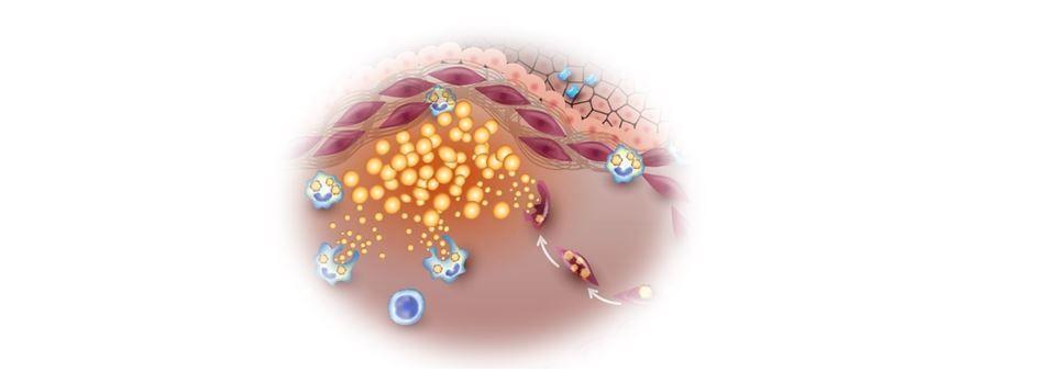 Study: HDL Anti-inflammatory Capacity Could Improve CVD Risk Assessment 