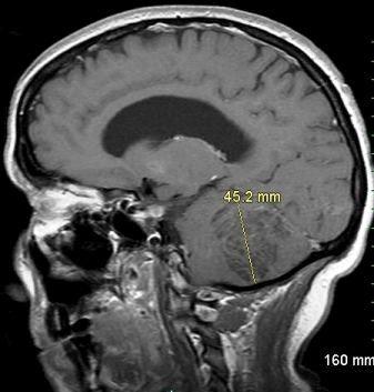 Neurological Nemeses: A Photo Essay