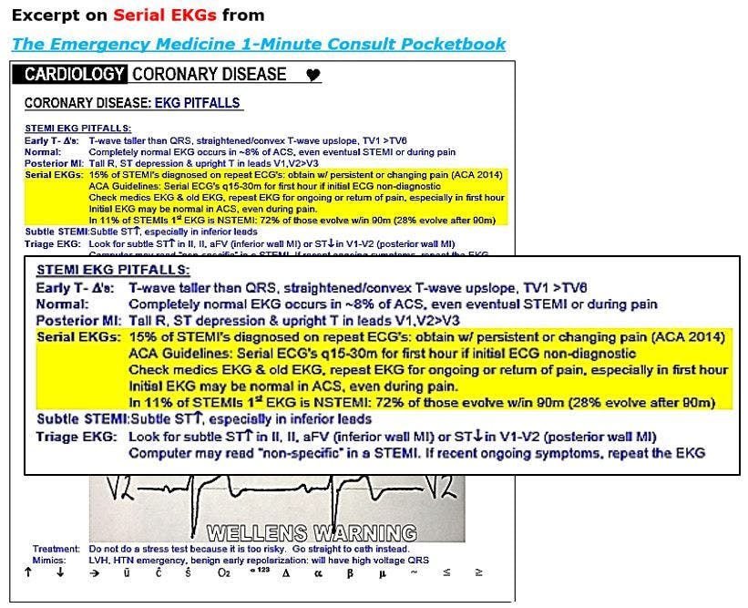 Serial EKGs, STEMI, ACS, acute coronary syndrome