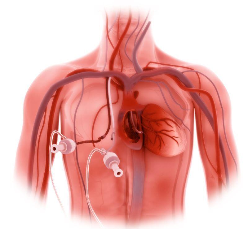 Autosomal-dominant Polycystic Kidney Disease: 3 Studies in Brief 