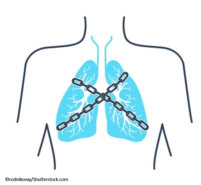 Vocal cord dysfunction, VCD, asthma 