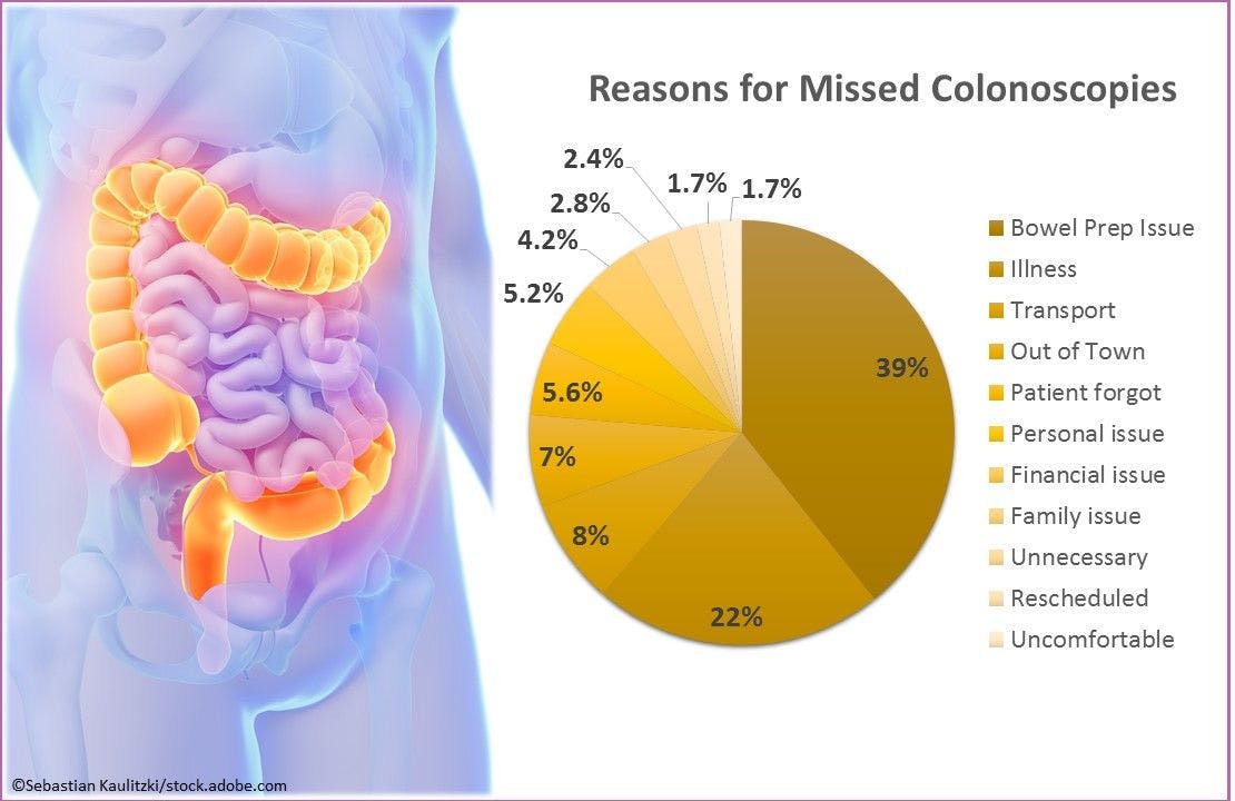 Bowel Preparation Understanding Major Barrier to Completion of Colonoscopy