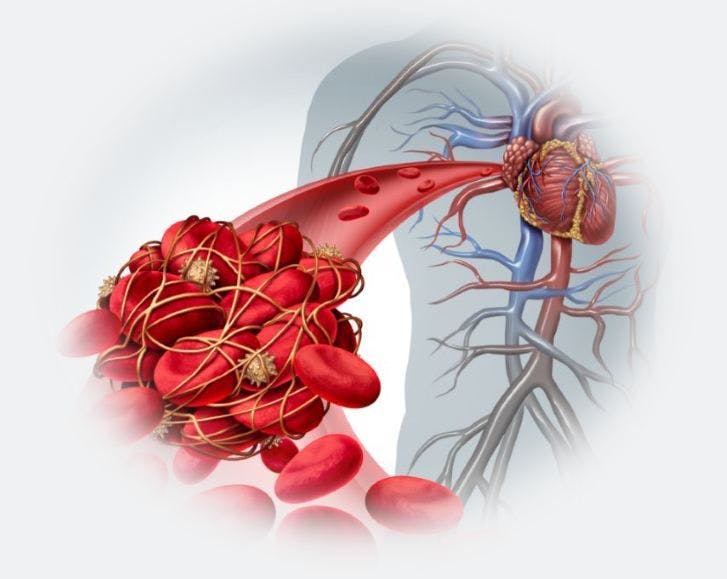 Atrial Fibrillation: A Spot Quiz