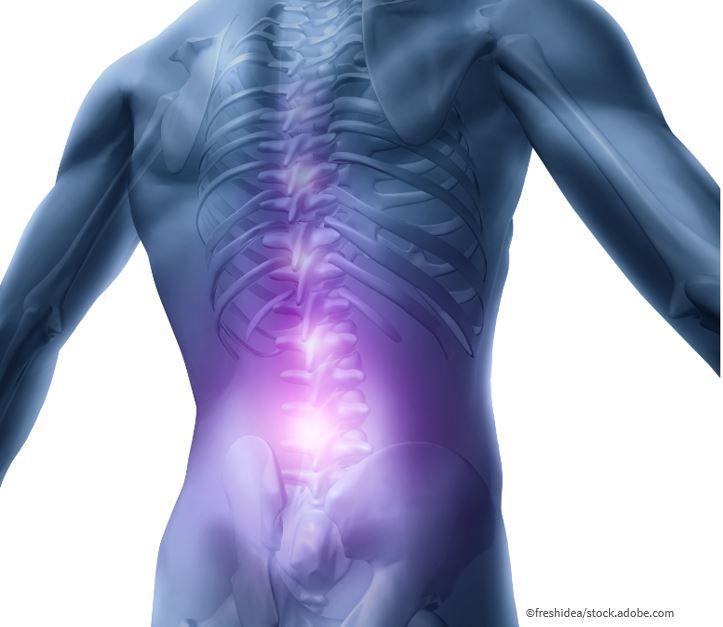 risk factors for and diagnosis of acute low back pain 