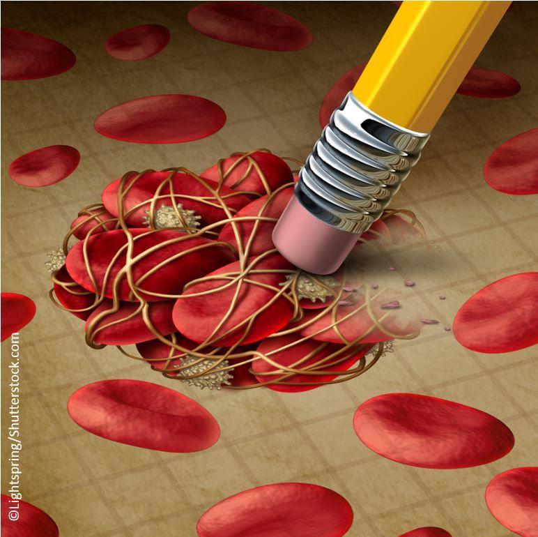 NOACs Linked to Lower Risk for Vascular Issues than Warfarin in Patients with Diabetes, Atrial Fibrillation