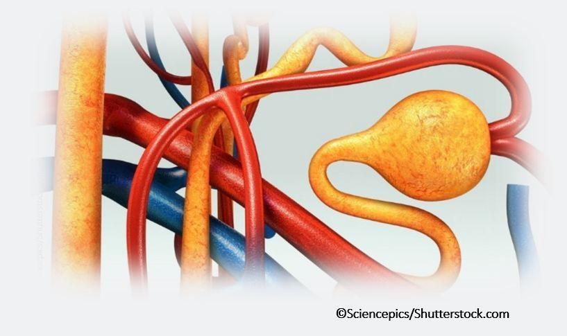 New-onset Afib in a Patient with CKD: A Case-based Quiz  