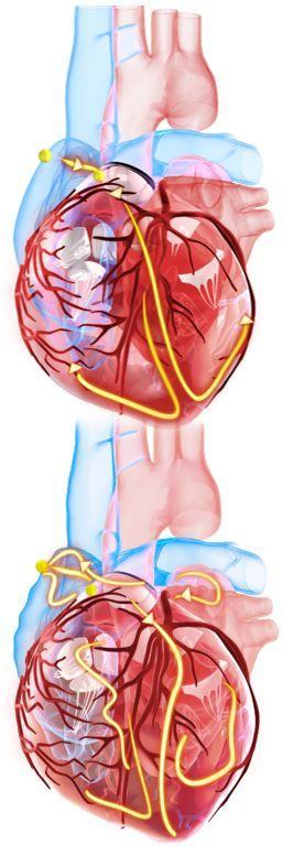 Worldwide Burden of Atrial Fibrillation More Than Doubled Over 30 Years: New Research / image credit ©TuMeggy/stock.adobe.com