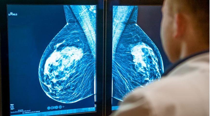 Screenings for Cancer, Other Preventive Visits Continue to Lag Post-Pandemic image credit mammograph: ©okrasniuk/stock.adobe.com 