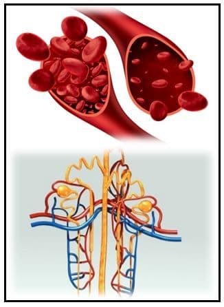 FDA Accepts Daprodustat NDA for Anemia of Chronic Kidney Disease