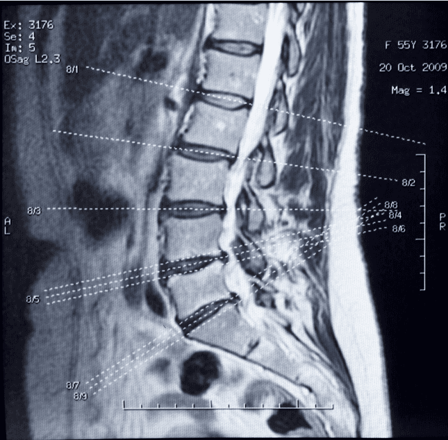 Pain Problems x3: Your Solutions? 