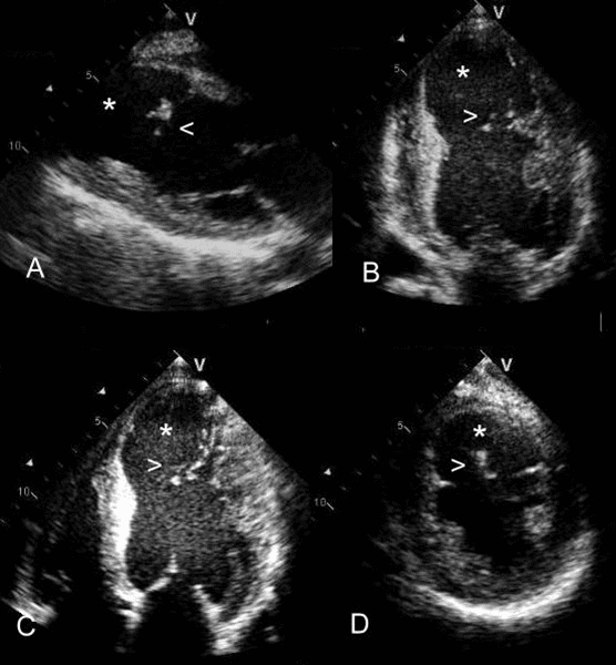 Echocardiographic views