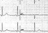 Organophosphate Poisoning Presenting as Syncope