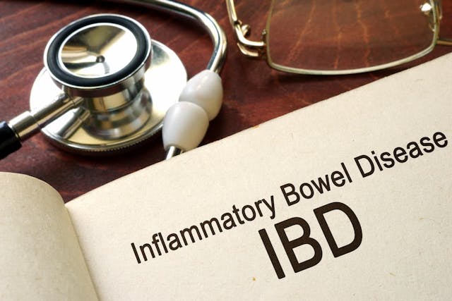 Study Reveals Disparities in Inflammatory Bowel Disease Based on Race, Sex, and Immigration Status / image credit: ©Vitalii Vodolazskyi/AdobeStock