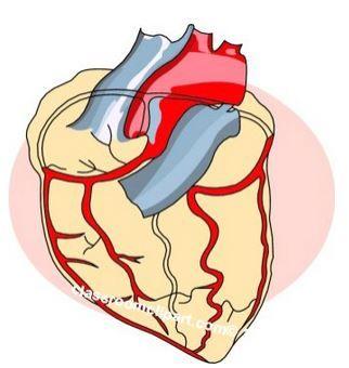 GLP-1 RA, cardioprotection 