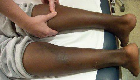 Go For The Glory Quiz: Drug-induced Hypersensitivity; Rhinosinusitis and Depression; Blue Nevus; Leg Injury