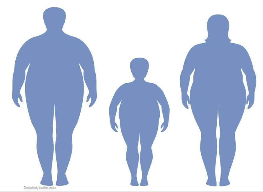 Obesity and the Musculoskeletal System: Age and Impact