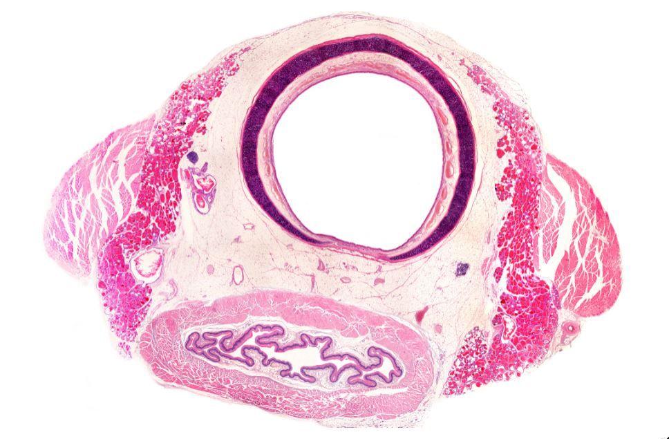 New Guidelines on Management of Achalasia Released by ASGE